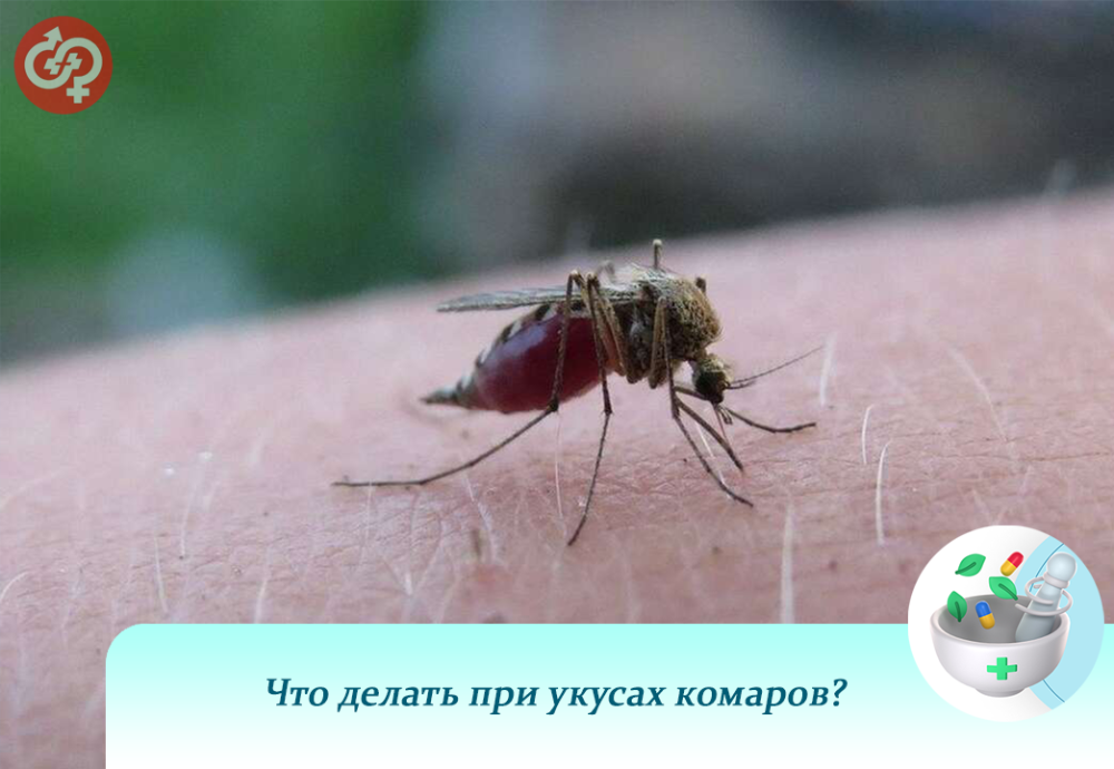 Что делать при укусах комаров?